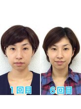 ビューティスタジオＫ/たるみ改善小顔矯正フェイシャル