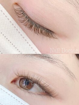 ネイルドクター(nail doctor)の写真/丁寧にヒアリングし顔の形や目の大きさに合わせ最適なデザインをご提案！自然に貴方の個性を引き出します♪