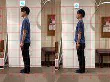 キラリ(KIRARI)/姿勢改善