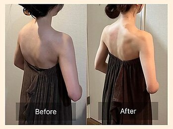 【肩こり/リンパマッサージ/小顔/ヘッドスパ】肩甲骨はがし肩こり整体RUFFREE高尾院/背中美人に大変化【高尾】