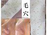 【黒ずみ・いちご鼻改善！】鼻のみエクストラクション+volayon韓国肌管理