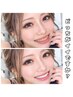 【1日1名限定】本気の美白ホワイトニング計35分照射!即4トーン白く♪10/14×