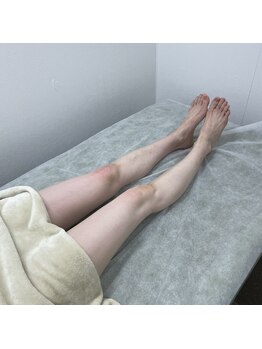 ナノハナ/鹿沼市全身脱毛ナノハナ