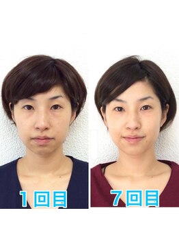 ビューティスタジオＫ/たるみ改善小顔矯正フェイシャル