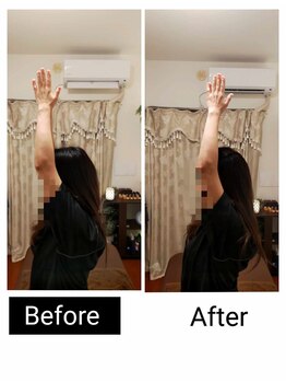 アース エンジェル整体院/ビフォアフ　肩こり　ストレッチ