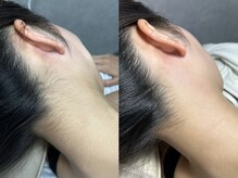 トゥウィーサロン 梅田(Tweesalon)/ツヤ肌フェイシャルワックス