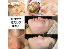 ビューティータワー(Beauty Tower)の雰囲気（毛穴ケア＆ハーブピーリングオプションでさらにお悩みに特化！　）