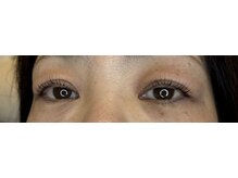 アールエム(Rm)/6月◇まつげ