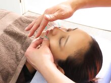 いん鍼灸治療院/＜顔への鍼施術＞