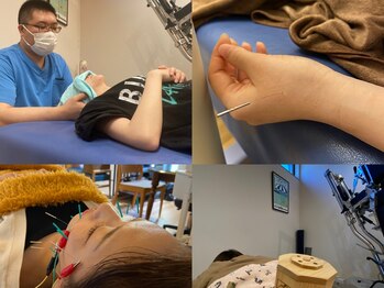 オラカナザワ(Ola Kanazawa)の写真/全身調整鍼灸＋美顔鍼＋姿勢骨盤矯正であなたの「キレイ」を最強サポート！！
