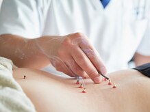 中目黒 佳鍼堂/温かくて心地の良いお灸です