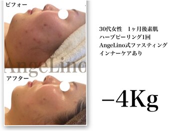 アンジェリーノ(AngeLino)/