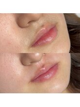 ブリス 姫路(Bliss)/お客様Before/After