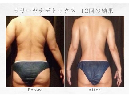 アユーラの写真