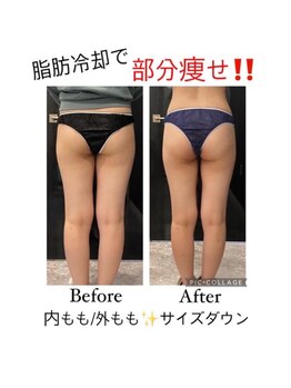 シャルム(CHARME)/寝ながらダイエット