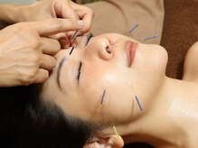 ティルナノーグイリニ(Tir Na Nog-EIRINI)の雰囲気(肌も、内側から整える。やさしく巡りを整える美容鍼)