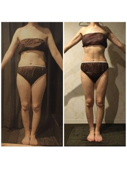 パーフェクトボディプレミアム 名古屋駅前店(PERFECT BODY PREMIUM)/お客様 ビフォーアフター(2)