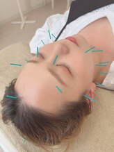ヒーリングサロン アージュ(A-je)/★美顔鍼＋小顔矯正★