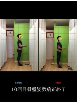 北てんま整骨鍼灸院/右腰、右股関節の不調!偏った体