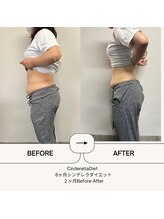 オーシャン整骨院(OCEAN整骨院)/６ヶ月コース