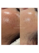 エクラ(eclat)/タラソトリートメント