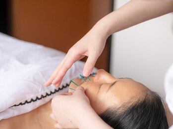 プラチナサロン 六本木の写真/リフトアップ美容鍼60分¥4980～【小顔&ハリ&引き締めに！リフトアップ美容鍼】初めての方もプロにお任せ！