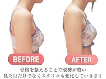 シエル(Siele)/首が前に伸びる現象