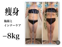 アンジェリーノ(AngeLino)/