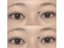 リグ(LIG)/ばっちり！