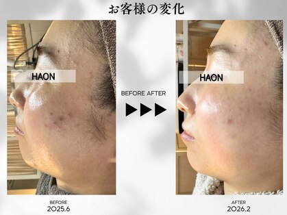 ハオン(HAON)の写真