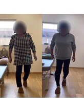 ランドル(rendre)/歩行時のひざの痛み