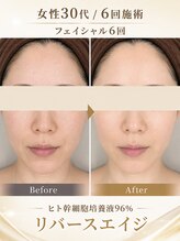 グラツィア(Grazia)&nbsp;田端 亜矢
