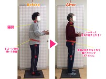 藤接骨院 焼津小川院/杖なしで歩けるように
