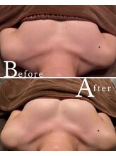 ロココ 水戸店(Rococo)/バストアップBefore &nbsp;After