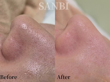 サンビ(SANBI)の写真