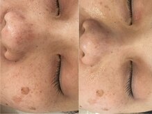 グレイティア(gratia)/韓国ララピール