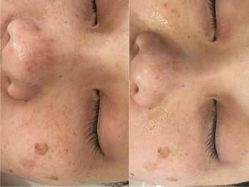 グレイティア(gratia)/韓国ララピール