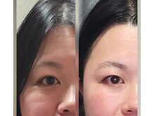 杏月(Kyozuki)/スタート前と５回目お手入れ後☆