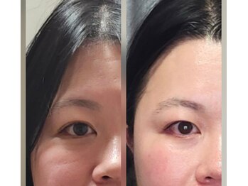 杏月(Kyozuki)/スタート前と5回目お手入れ後☆