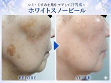 スイ 昭島店(Sui)の雰囲気(夏に向けて輝く素肌へ!1回で首元までトーンUPする白雪肌エステ)