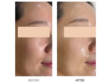 ナチュリー(Naturry)の雰囲気（韓国人のような“水光肌”が叶う！すっぴんでも自信あるお肌に。）