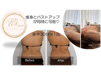 アールズマム(R’s mum)の写真