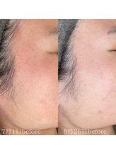 マール(MARL.)/クリスティーナトリートメント