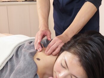 リアン鍼灸接骨院の写真/【整体だけでは改善しないその首肩コリ改善】現代人のお悩み、頭痛/めまい/眼精疲労にも効果◎