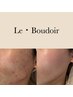 Le・Boudoir 肌質改善3ヶ月プログラム（6回)ホームケアつき¥75,020→¥59,400