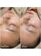 モンクラッシー(Mon classy)/