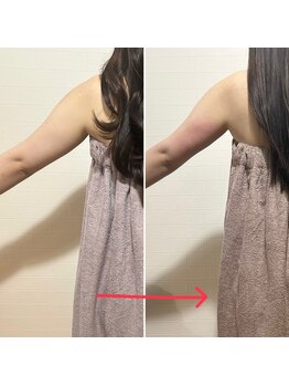 ルーチェエムベルシック(Luce.MBelChic)/ブライダルエステ