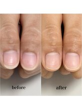 ニカ(Nica)/【自爪育成】お試しケア