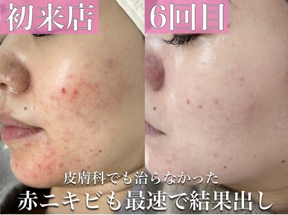 シルキー 新宿店(SILKY)の写真