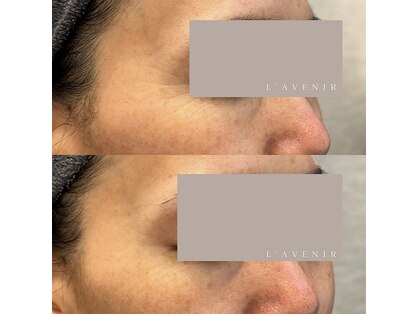 ラヴニール(L'avenir)の写真